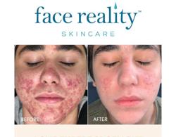 Real Results Skin Care