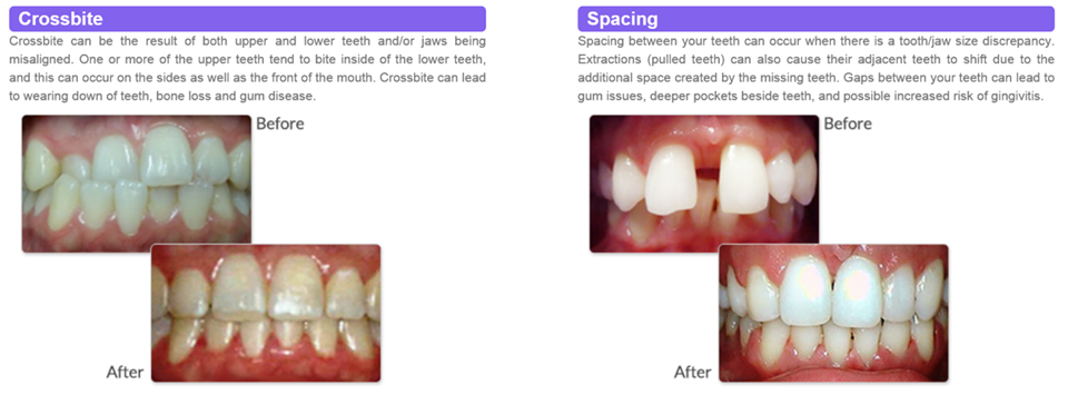 Modern Family Dental 779 FM1187, Crowley Texas 76036