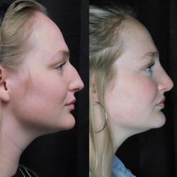 Exclusively Faces Cosmetic Surgery and Medispa