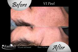 Radiance Skin Therapy & Laser Center